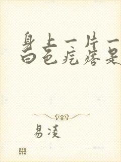 身上一片一片的白色疙瘩是怎么回事