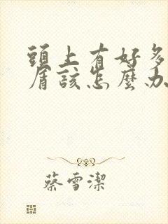 头上有好多头皮屑该怎么办