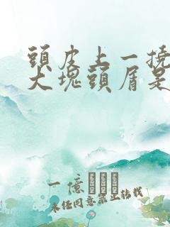 头皮上一挠就一大块头屑是怎么回事