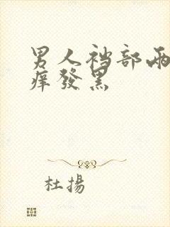 男人裆部两侧瘙痒发黑