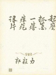 很痒一抓起起一片疙瘩怎么办