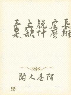 手上脱皮长倒刺是缺什么维生素