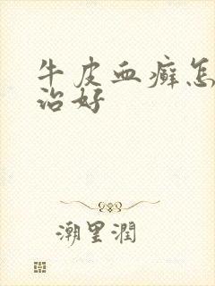 牛皮血癣怎样能治好