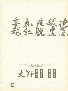 睾丸痒越挠越痒越红脱皮怎么治疗