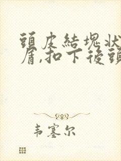 头皮结块状头皮屑,扣下后头皮红的