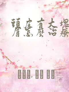 头皮有大块头皮屑怎么治疗