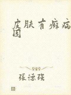 皮肤有癣病的原因