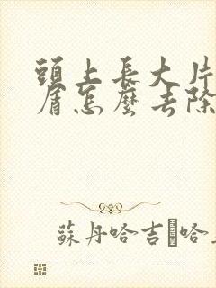 头上长大片头皮屑怎么去除