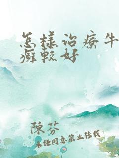 怎样治疗牛皮有癣较好