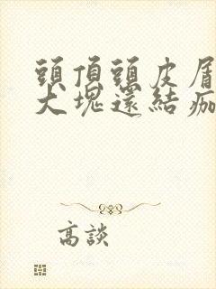 头顶头皮屑多且大块还结痂