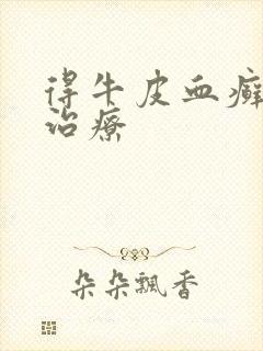 得牛皮血癣怎么治疗