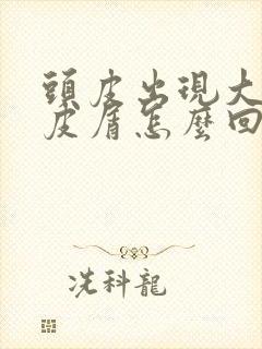 头皮出现大片头皮屑怎么回事