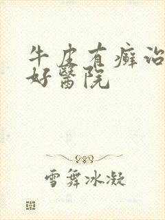 牛皮有癣治疗最好医院