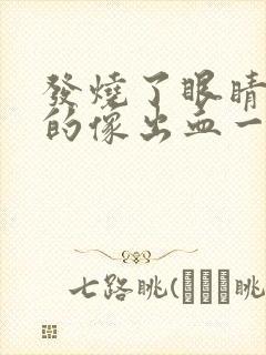 发烧了眼睛红红的像出血一样是怎么回事