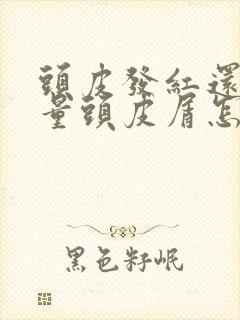 头皮发红还有大量头皮屑怎么办