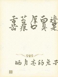 舌苔厚白边缘有齿痕口臭是怎么回事