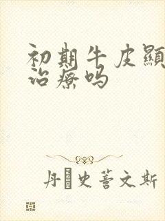 初期牛皮显可以治疗吗