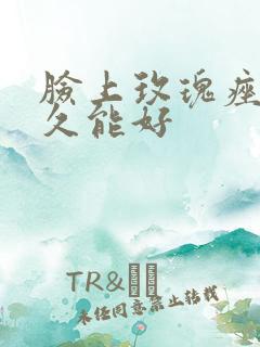 脸上玫瑰痤疮多久能好