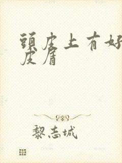 头皮上有好多头皮屑