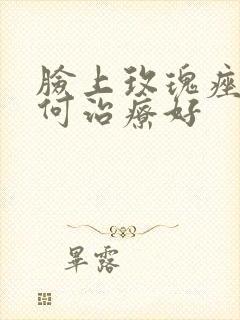 脸上玫瑰痤疮如何治疗好