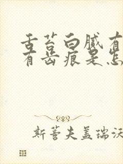 舌苔白腻有裂纹有齿痕是怎么回事