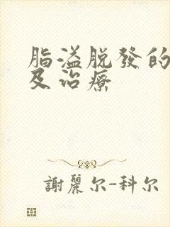 脂溢脱发的原因及治疗