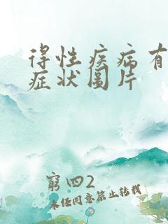 得性疾病有哪些症状图片