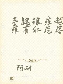 手腿很痒越抓越痒有红疙瘩