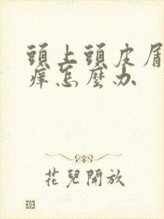 头上头皮屑多又痒怎么办