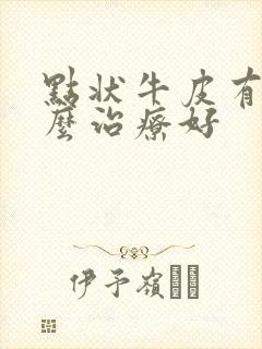 点状牛皮有癣怎么治疗好