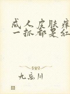 成人皮肤痒痒,一抓都是红点点