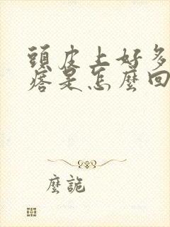 头皮上好多小疙瘩是怎么回事