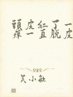 头皮红了一块很痒一直脱皮的