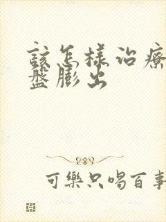 该怎样治疗腰椎盘膨出