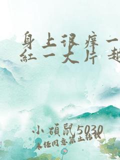 身上很痒一抓就红一大片 越热越痒