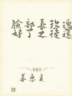 脸部长玫瑰痤疮好了之后还反复起