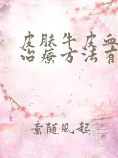 皮肤牛皮血癣的治疗方法有哪些