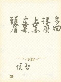 头皮上很多头皮屑是怎么回事