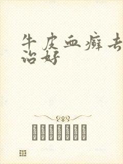 牛皮血癣去哪里治好