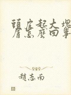 头皮起大块头皮屑怎么回事