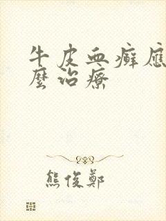 牛皮血癣应该怎么治疗