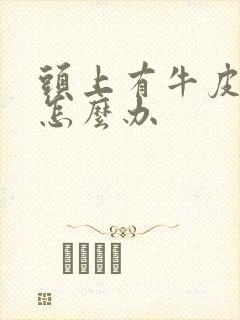 头上有牛皮血癣怎么办