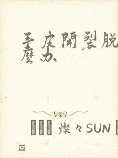 手皮开裂脱皮怎么办