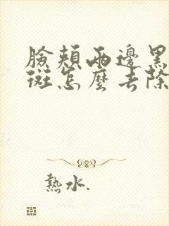 脸颊两边黑色素斑怎么去除