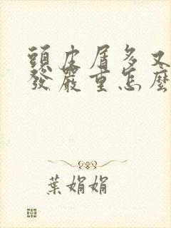 头皮屑多又痒掉发严重怎么治疗