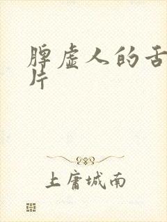 脾虚人的舌头图片