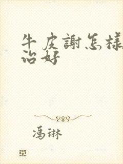 牛皮谢怎样才能治好