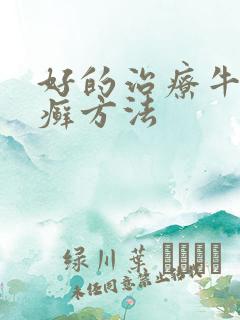 好的治疗牛皮有癣方法