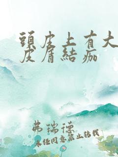 头皮上有大块头皮屑结痂