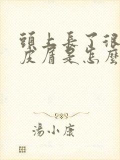 头上长了很多头皮屑是怎么回事